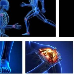 Common Sports Injuries: Prevention, Treatment, and Recovery Tips